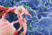 【原因不明】ロシアの主要なウイルス研究所が爆発　HIV、エボラ、炭疽菌、天然痘など貯蔵