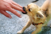 【閲覧注意】犬に腕を噛まれたチンさん、とんでもないことになるｗｗｗｗｗｗｗｗｗｗｗｗｗ