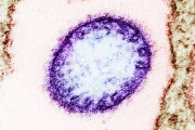 致死率40～75%、インドでニパウイルスの感染者発生
