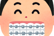 【謎】歯並び悪い奴が歯列矯正をしない理由www