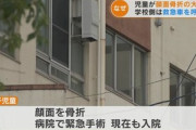 小学校で児童が顔面骨折の大けが 学校は救急車を呼ばず…駆け付けた母親の通報で搬送され緊急手術