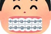 歯列矯正したいんやが？