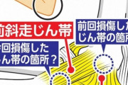エンゼルス・大谷の手術は「トミー・ジョン」でも「保存療法」でもない全く新しい術式