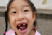 中国メディア…ロボットに蹴られた5歳女児、歯が4本抜ける ［8/26］