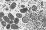 欧州でサル痘拡大、100人超感染か　同じパーティーに出席で感染　米加豪でも感染報告