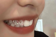 推し活界隈でも注目？　歯をデコレーションする「ティースジュエリー」　歯科医が話すトレンドと注意点