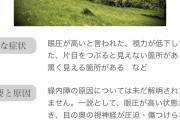 【緊急】ワイの視界、『謎のギザギザ』のせいで逝く…