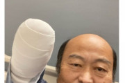 【野球】元近鉄・佐野慈紀氏、右腕切断写真を公開「至って元気です」手術部分は包帯でぐるぐる巻き