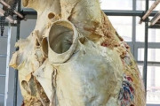 【画像】クジラさんの心臓、デカすぎるｗｗｗｗｗ