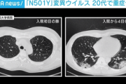 【警告】コロナ変異株「N501Y」がヤバすぎる　基礎疾患のない20代も重症化