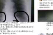 【画像】 反ワクチン派「接種した妊婦が産んだ赤ちゃんが次々と肺出血を起こし死亡！」とレントゲン写真を投稿  ⇒ 新潟大学に教材にされ慌てて削除