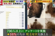 新型コロナの後遺症で１６％の人がハゲる事が判明　髪の毛の４～５割が抜け落ちる
