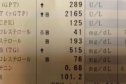 5年間毎日ビール飲み続けた結果wwww