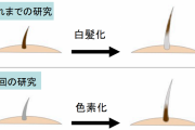 【衝撃】「白髪」元に戻ることが判明！髪はストレスの有無によって色を変えるらしい