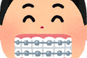 【疑問】ガチャ歯の奴が矯正しない理由って？