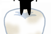 虫歯って放置したらどうなるん？ｗｗｗｗｗｗｗ