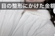 【神画像】ぐうかわ女さん「目の整形にかけた金額を発表するやで〜ｗ」