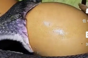 【画像】卵を丸呑みしようとした蛇、とんでもないことになる。。。