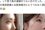 【画像】まんさん「鼻がコンプレックスだったがお医者様に感謝👩」