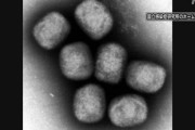 【悲報】サル痘感染者7例目に→東京都「把握できている。拡大している状況ではない」