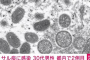 東京で2人目の｢サル痘｣感染者確認