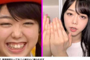 歯列矯正した芸能人の劇的ビフォーアフター　元アイドル、大河女優、“口元排水溝”芸人まで