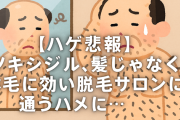 【ハゲ悲報】神薬ミノキシジルが髪じゃなくて体毛に効いて脱毛サロンに通うハメに…
