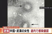 中国武漢の女性、北海道で新型ウィルス感染確認