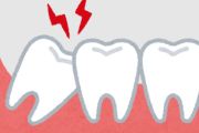 歯医者に行ってレントゲン撮ったら親知らずあったんやが