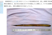 【画像】「お腹痛いよ、タスケテ」→お腹の中から体長50cmのウナギ見つかり緊急入院…