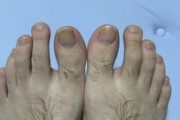 【毛ｗ】ワイの足指、クッソ長い（※画像あり）