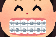 歯列矯正ってメリットある？