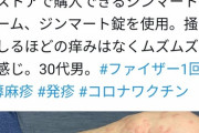 【画像】ファイザー製ワクチン1回目を打った30代男性、毎日繰り返し全身に発疹が出るようになる