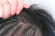 【朗報】ストレスによる『白髪』→ストレス解消で元の色に戻る可能性