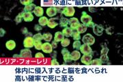 【アメリカのテキサス州】人間の脳を食べるアメーバ―が水道水に汚染される