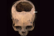インカ文明の「穿頭手術」、その凄まじい成功率が明らかに