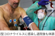 コロナ後遺症、世界で続出  倦怠や息苦しさ、関節痛…