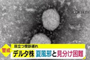 【新型コロナ】デルタ株の恐ろしさ、なんと夏風邪の症状と見分けがつかない