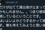 【悲報】例の骨延長失敗の人、医者にアウト宣告される