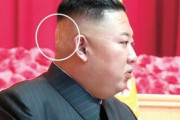 【平壌スタイル】後頭部に「バンド」を貼った金正恩委員長 [8/2]  [右大臣・大ちゃん之弼★]