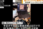 脳に小型チップを入れた患者がチェス…「画面を見つめるだけでカーソルが動く」！