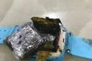 【閲覧注意】 中国、スマートウォッチが爆発！　女児の手が損傷してしまう 「すぐ外せなければ手が失われていた可能性」