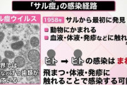 【悲報】サル痘、ガチで洒落にならなそう…日本での初確認も時間の問題か