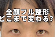 ［朗報］陰キャ男性さん　整形してイケメンになってしまう