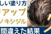【朗報】ワイ若ハゲ(29)、明日からたっぷり睡眠と運動をすることを決意!