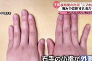 【悲報】スマホ指、ガチで社会問題へ
