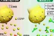 【画像】片頭痛の新薬がついに登場ｷﾀ━━━━(ﾟ∀ﾟ)━━━━!!