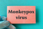 【終わりの始まり】東京都内で国内初「サル痘」の感染者を確認