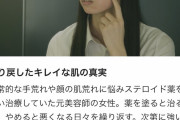 日テレの番組が『脱ステロイドで美肌に！』という内容を放送　→ 監修がトンデモ療法で訴えられた医師  [306759112]