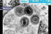 【東京慈恵会医大】うつ病の原因となるウイルスの遺伝子を発見　スター・ウォーズの暗黒卿に擬え「SITH－1遺伝子」と命名